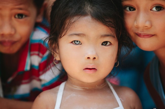 Asiatisches Kleinkind mit verschieden farbigen Augen