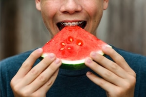 Junge, Bub, Teenager, Zahnspange, Melone, Zähne